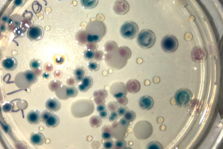 top down view of circular culture plate, with a variety of sizes of scattered blobs: black, white, brown, and clear